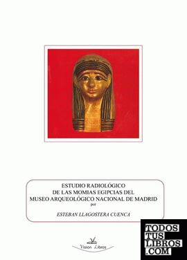Estudio radiológico de las momias egipcias del Museo Arqueológico Nacional de Madrid