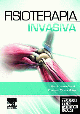 Fisioterapia invasiva + acceso web