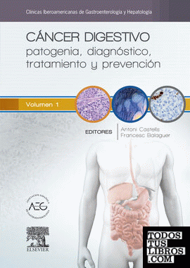 Cáncer digestivo: patogenia, diagnóstico, tratamiento y prevención
