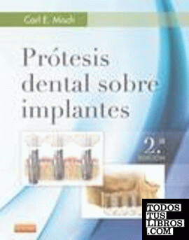 Prótesis dental sobre implantes (2ª ed.)
