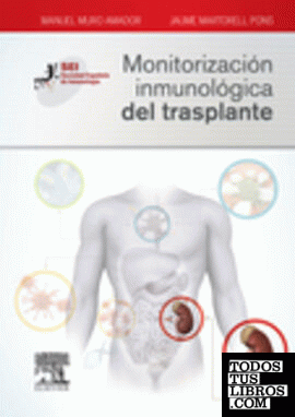 Monitorización inmunológica del trasplante
