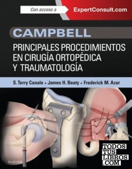 Campbell. Principales procedimientos en cirugía ortopédica y traumatología