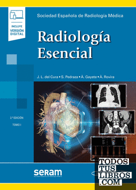 Radiología Esencial