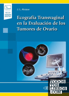 Ecografía transvaginal en la evaluación de los tumores de ovario