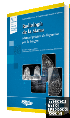 Radiología de la Mama(+ebook)