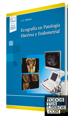 Ecografía en Patología Uterina y Endometrial