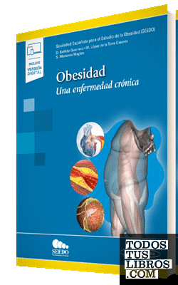 Obesidad (+ e-book)