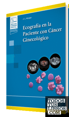 Ecografía en la Paciente con Cáncer Ginecológico (e-book)