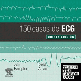 150 casos de ECG