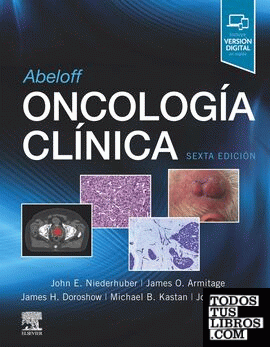 Abeloff. Oncología clínica
