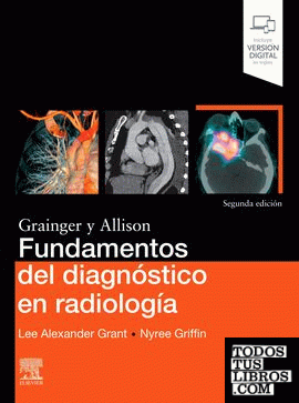 Fundamentos del diagnóstico en radiología