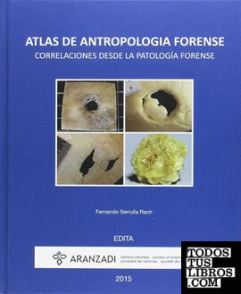 Atlas de antropología forense