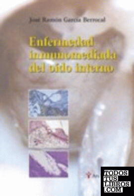 Enfermedad inmunomediada del oído interno