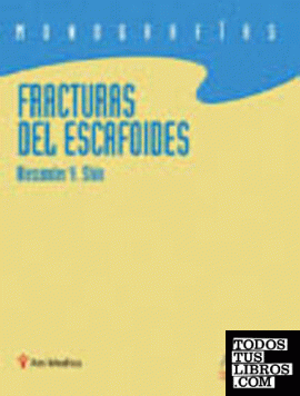 Fracturas del escafoides. Monografías de la AAOS
