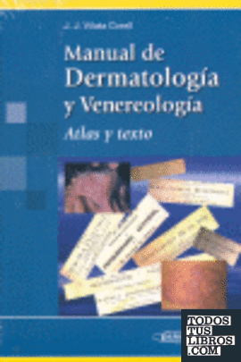Manual de Dermatología y Venereología