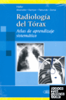 HOFER:Radiologia del Torax.Atlas