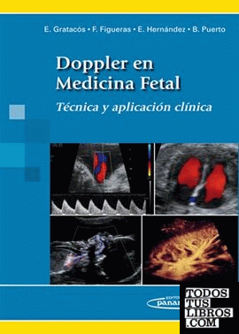 Doppler en medicina fetal