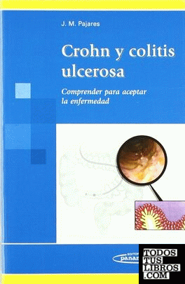 Enfermedad de Crohn y Colitis Ulcerisa
