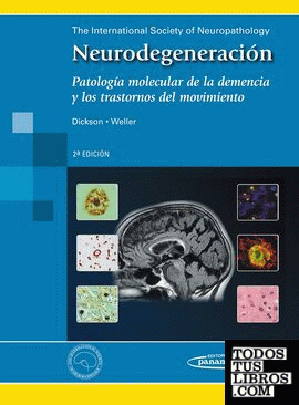 Neurodegeneración