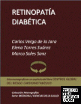 Retinopatía diabética Retinopatía diabética