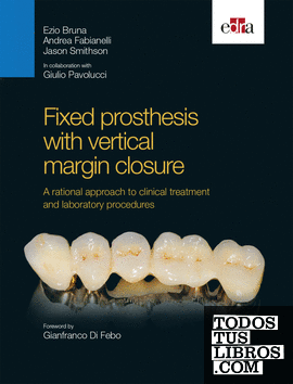 Fixed prosthesis with vertical margin closure. A rational approach to clinical treatment and laboratory procedures