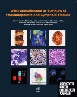 WHO CLASSIFICATION OF TUMOURS OF HAEMATOPOIETIC AND LYMPHOID TISSUES: VOL. 2.4ª