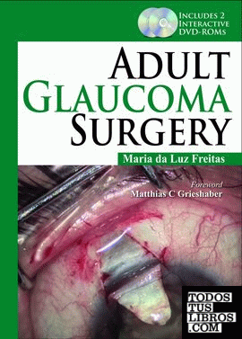 ADULT GLAUCOMA SURGERY
