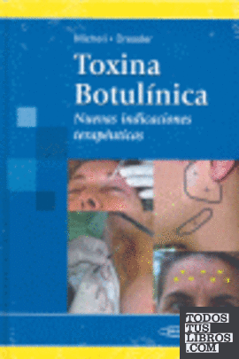 Toxina Botulnica