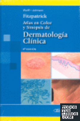 Fitzpatrick: Atlas En Color Y Sinopsis De Dermatología Clínica De Wolff ...