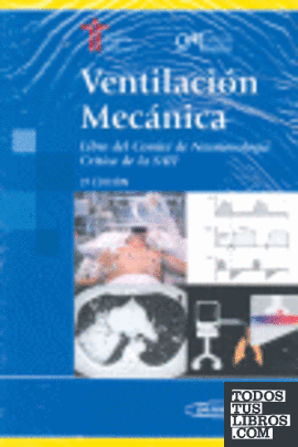 2º. VENTILACION MECANICA. LIBRO DEL COMITE DE NEUMOLOGIA CRITICA