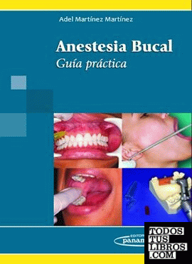 MARTINEZ:Anestesia Bucal. Gua Prctica