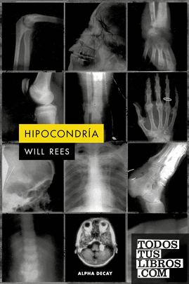 HIPOCONDRIA